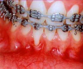 basic orthodontics course in India